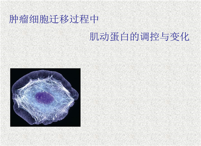 15_肿瘤细胞迁移中的信号通路