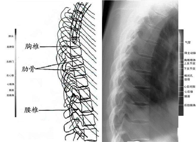 30_如何看颈腰椎x光片