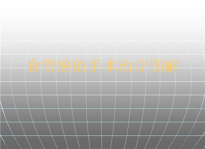 08_食管癌的手术治疗图解