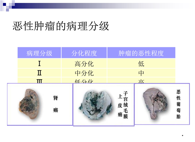 08_肿瘤常用治疗方法及市场探讨